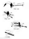 Fig. 22 - Method and apparatus for repairing a hernia