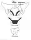 Fig. 01 - LEVATOR FOR REPAIR OF PERINEAL PROLAPSE