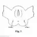 Fig. 06 - LEVATOR FOR REPAIR OF PERINEAL PROLAPSE