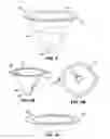 Fig. 07 - Gastrointestinal implants