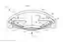 Fig. 01 - Buttressed haptic