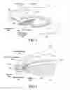 Fig. 02 - INTRAOCULAR LENS SYSTEM AND METHOD FOR POWER ADJUSTMENT