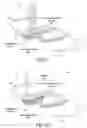 Fig. 07 - INTRAOCULAR LENS SYSTEM AND METHOD FOR POWER ADJUSTMENT