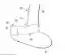 Fig. 01 - Bone Implant Apparatus and Method