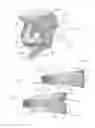 Fig. 02 - Expandable intervertebral implant