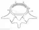 Fig. 01 - In-situ formed intervertebral fusion device and method