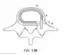 Fig. 22 - In-situ formed intervertebral fusion device and method