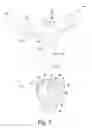 Fig. 03 - Surgical instrument and method of disassembling a tibial prosthesis