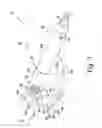 Fig. 04 - Surgical instrument and method of disassembling a tibial prosthesis