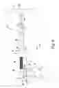 Fig. 07 - Surgical instrument and method of disassembling a tibial prosthesis