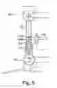 Fig. 06 - Lower limb prosthesis