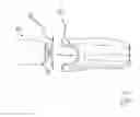 Fig. 03 - Prosthesis liner with suction cup and vacuum lock mechanism