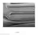 Fig. 10 - NANO-CARRIER EMBEDDED SURFACE FOR INSERTABLE MEDICAL DEVICES