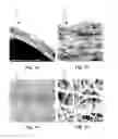 Fig. 03 - Graft devices and related systems and methods