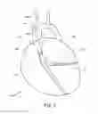Fig. 07 - Graft devices and related systems and methods