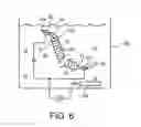 Fig. 05 - Electrically charged medical device