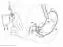 Fig. 01 - FLOATING GASTROINTESTINAL ANCHOR