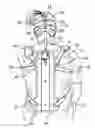 Fig. 01 - Cervical spine orthosis