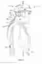 Fig. 04 - Cervical spine orthosis