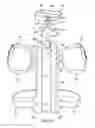 Fig. 10 - Cervical spine orthosis