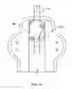 Fig. 13 - Cervical spine orthosis