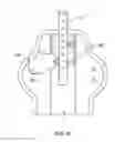 Fig. 14 - Cervical spine orthosis