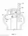 Fig. 15 - Cervical spine orthosis