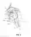 Fig. 05 - PARTIALLY ERODABLE SYSTEMS FOR TREATMENT OF OBSTRUCTIVE SLEEP APNEA