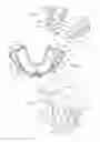 Fig. 02 - Intrabuccal device comprising bite trays and connecting rods