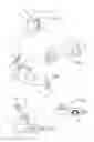 Fig. 03 - Intrabuccal device comprising bite trays and connecting rods