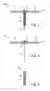 Fig. 02 - Intrauterine Device