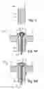 Fig. 04 - Intrauterine Device