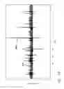 Fig. 16 - Modulated pulsed ultrasonic power delivery system and method