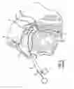 Fig. 06 - Eustachian tube dilation balloon with ventilation path