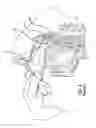 Fig. 07 - Eustachian tube dilation balloon with ventilation path