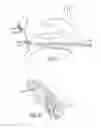 Fig. 08 - Eustachian tube dilation balloon with ventilation path