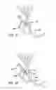 Fig. 09 - Eustachian tube dilation balloon with ventilation path