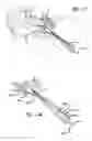 Fig. 11 - Eustachian tube dilation balloon with ventilation path