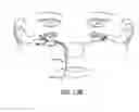 Fig. 12 - Eustachian tube dilation balloon with ventilation path