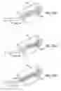Fig. 15 - Eustachian tube dilation balloon with ventilation path