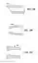 Fig. 31 - Eustachian tube dilation balloon with ventilation path