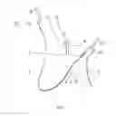 Fig. 02 - Absorbent Article