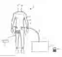 Fig. 01 - System for therapeutic treatment by vacuum pressure and method of use thereof