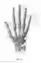 Fig. 03 - Non-invasive methods for prevention, detection, treatment, and healing of neoplastic processes in humans