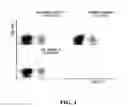 Fig. 02 - Use of liposomes in a carrier comprising a continuous hydrophobic phase as a vehicle for cancer treatment