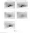 Fig. 11 - Immune cell activation inhibitor and use thereof