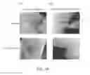 Fig. 12 - Immune cell activation inhibitor and use thereof