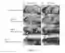 Fig. 13 - Immune cell activation inhibitor and use thereof