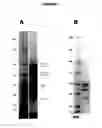 Fig. 08 - STABILISED PROTEINS FOR IMMUNISING AGAINST STAPHYLOCOCCUS AUREUS