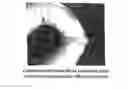 Fig. 01 - Demineralized Bone Matrix